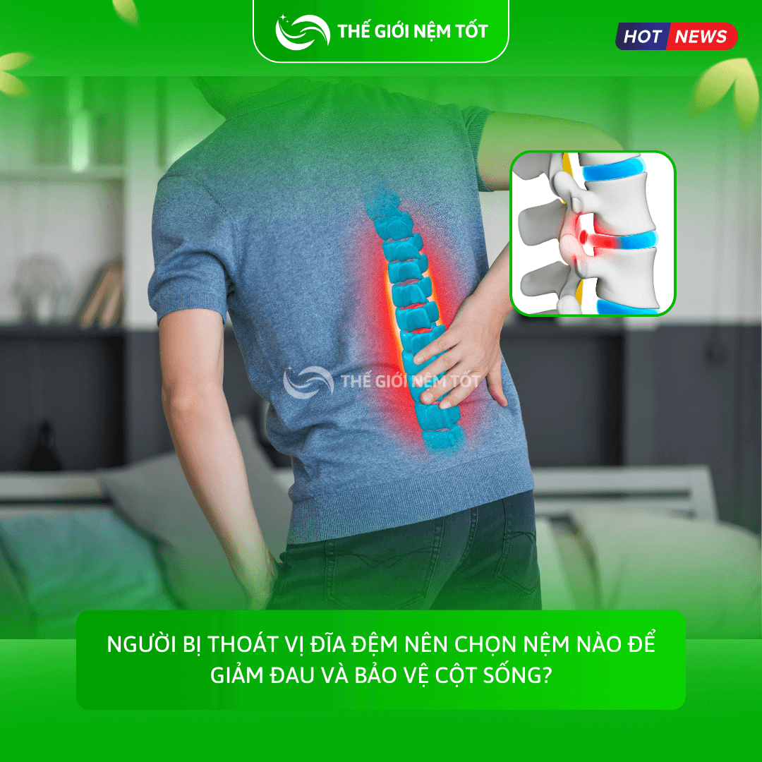 Người bị thoát vị đĩa đệm nên chọn nệm nào để giảm đau và bảo vệ cột sống?